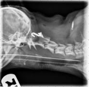 x-ray with hook inside throat