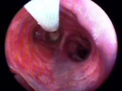 The interior of a dog's trachea as seen through a bronchoscope