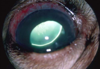 A close up image of glaucoma in an eye