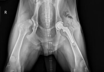 An x-ray of a total hip replacement